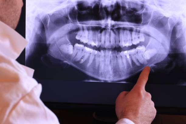 Best Dental Emergency Near Me  in Lakes Of The Four Seasons, IN