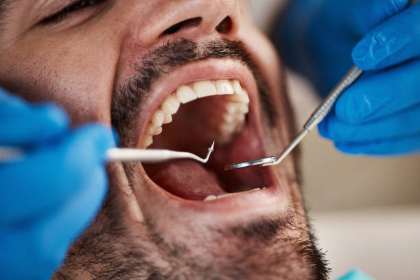 Best Tooth Infection Emergency Dentist  in Lakes Of The Four Seasons, IN