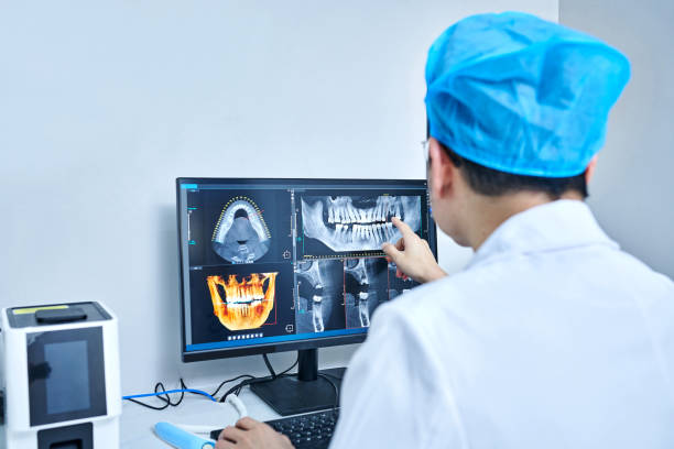 Best Chipped Tooth Repair Near Me  in Lakes Of The Four Seasons, IN